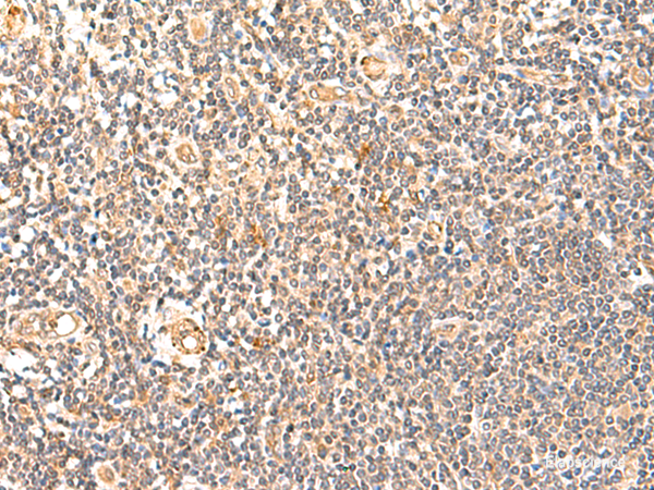 Immunohistochemistry of paraffin-embedded Human tonsil tissue using GPD1L Polyclonal Antibody at dilution of 1:60(×200)