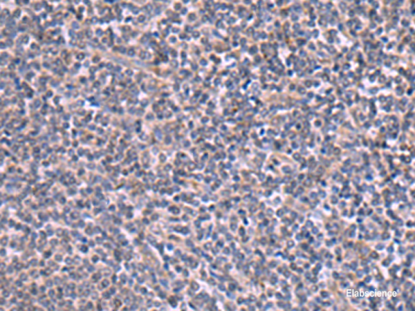 Immunohistochemistry of paraffin-embedded Human tonsil tissue using RIC3 Polyclonal Antibody at dilution of 1:90(×200)