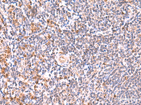 Immunohistochemistry of paraffin-embedded Human tonsil tissue using GMDS Polyclonal Antibody at dilution of 1:55(×200)
