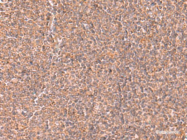 Immunohistochemistry of paraffin-embedded Human tonsil tissue using RABEPK Polyclonal Antibody at dilution of 1:65(×200)