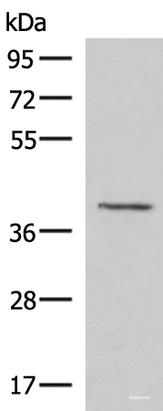 Western blot analysis of Human fetal brain tissue lysate using MECR Polyclonal Antibody at dilution of 1:1000