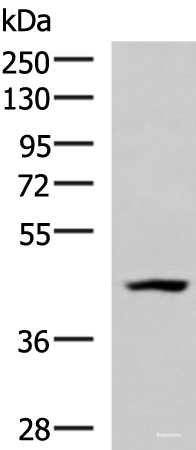 Western blot analysis of 293T cell lysate using MAGEC2 Polyclonal Antibody at dilution of 1:700