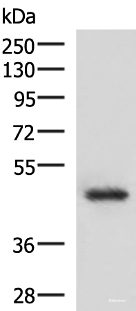Western blot analysis of 293T cell lysate using LDB1 Polyclonal Antibody at dilution of 1:1000