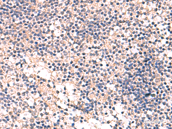 Immunohistochemistry of paraffin-embedded Human tonsil tissue using MKS1 Polyclonal Antibody at dilution of 1:50(×200)