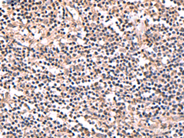 Immunohistochemistry of paraffin-embedded Human tonsil tissue using PER3 Polyclonal Antibody at dilution of 1:70(×200)