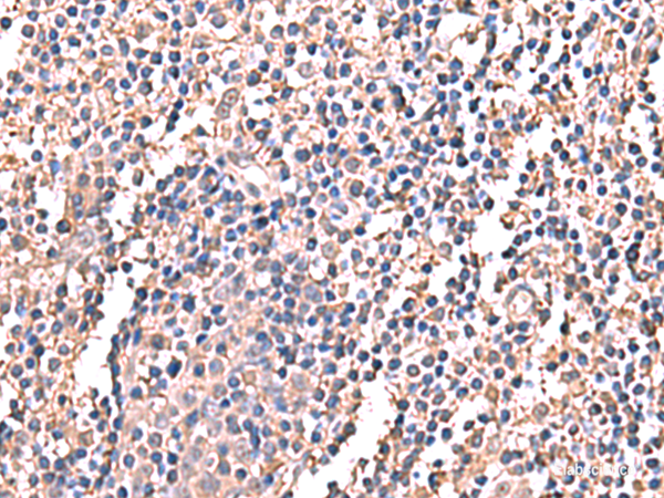 Immunohistochemistry of paraffin-embedded Human tonsil tissue using LDHAL6B Polyclonal Antibody at dilution of 1:60(×200)