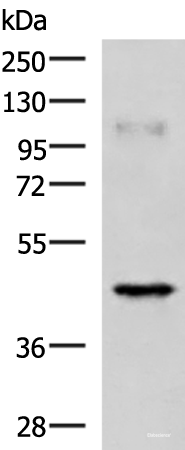 Western blot analysis of Human muscle tissue lysate using RAB3IL1 Polyclonal Antibody at dilution of 1:1000