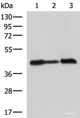 Western blot analysis of A549 Hela and HepG2 cell lysates using PDHA1 Polyclonal Antibody at dilution of 1:750