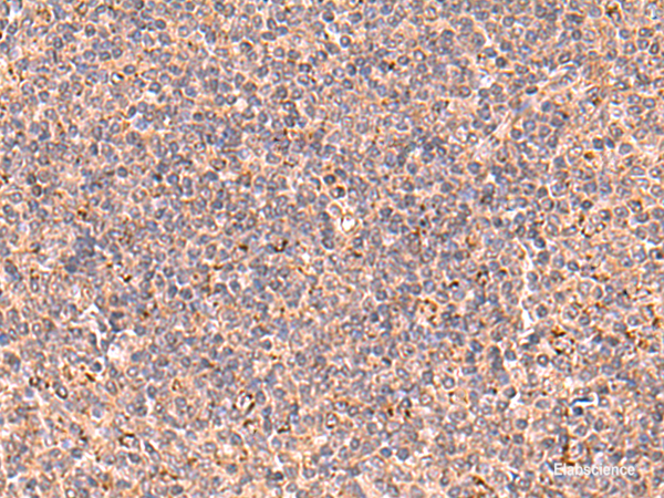 Immunohistochemistry of paraffin-embedded Human tonsil tissue using UBAC1 Polyclonal Antibody at dilution of 1:60(×200)