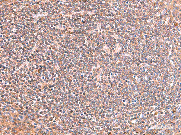Immunohistochemistry of paraffin-embedded Human tonsil tissue using PHKG2 Polyclonal Antibody at dilution of 1:60(×200)