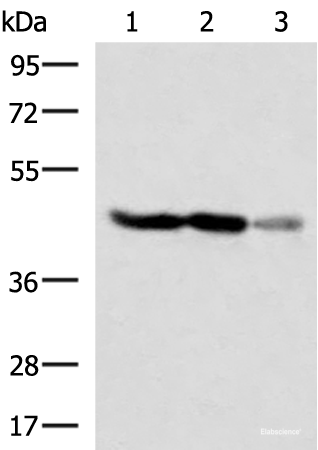 Western blot analysis of HT29 and HepG2 cell Human fetal brain tissue lysates using FDFT1 Polyclonal Antibody at dilution of 1:1000