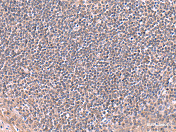 Immunohistochemistry of paraffin-embedded Human tonsil tissue using RIC8A Polyclonal Antibody at dilution of 1:80(×200)