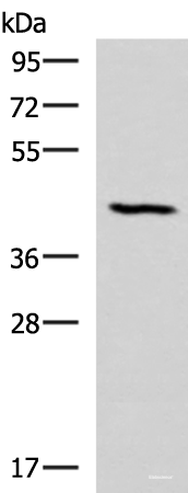 Western blot analysis of Mouse lung tissue lysate using SMPD2 Polyclonal Antibody at dilution of 1:1000