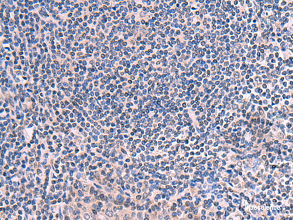 Immunohistochemistry of paraffin-embedded Human tonsil tissue using SCCPDH Polyclonal Antibody at dilution of 1:50(×200)