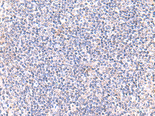 Immunohistochemistry of paraffin-embedded Human tonsil tissue using IFT57 Polyclonal Antibody at dilution of 1:85(×200)