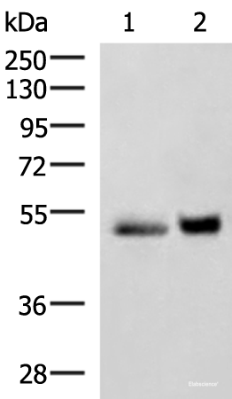 Western blot analysis of Human right lower lung tissue and Human plasma solution lysates using SIGLEC6 Polyclonal Antibody at dilution of 1:650