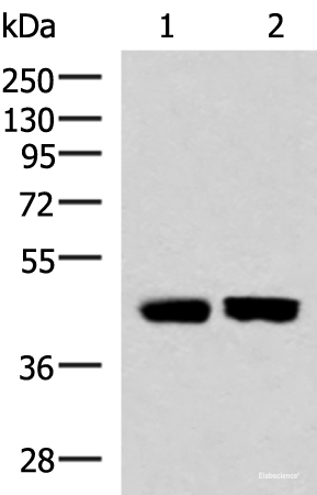 Western blot analysis of Human fetal liver tissue and Human liver tissue lysates using KIR3DL1 Polyclonal Antibody at dilution of 1:1000