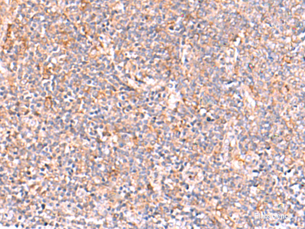 Immunohistochemistry of paraffin-embedded Human tonsil tissue using NADK Polyclonal Antibody at dilution of 1:95(×200)