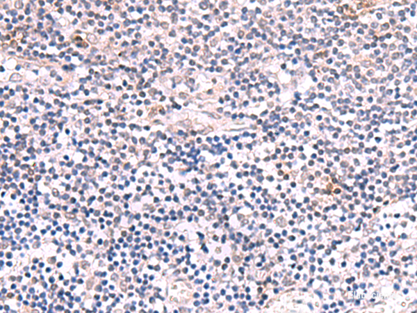 Immunohistochemistry of paraffin-embedded Human tonsil tissue using INPP5K Polyclonal Antibody at dilution of 1:85(×200)