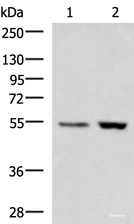 Western blot analysis of Human placenta tissue LOVO cell lysates using ZSWIM1 Polyclonal Antibody at dilution of 1:550