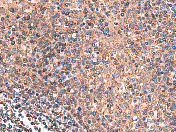 Immunohistochemistry of paraffin-embedded Human tonsil tissue using GALK2 Polyclonal Antibody at dilution of 1:160(×200)