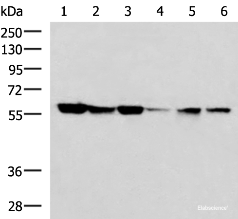 Western blot analysis of 293T 231 K562 Jurkat and Hela cell lysates using FKBP4 Polyclonal Antibody at dilution of 1:700