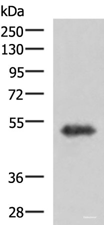 Western blot analysis of Human fetal brain tissue lysate using TSEN2 Polyclonal Antibody at dilution of 1:1000