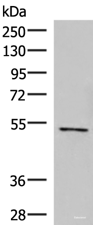 Western blot analysis of Jurkat cell lysate using POLD2 Polyclonal Antibody at dilution of 1:800