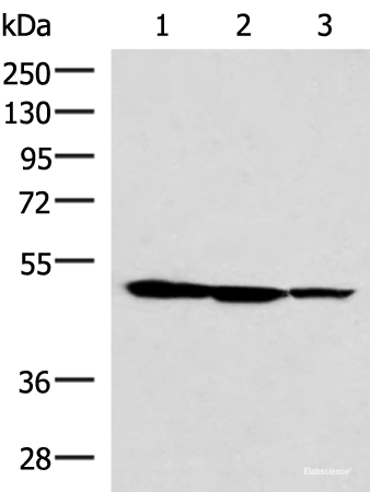 Western blot analysis of HepG2 K562 and A172 cell lysates using TTC38 Polyclonal Antibody at dilution of 1:1000