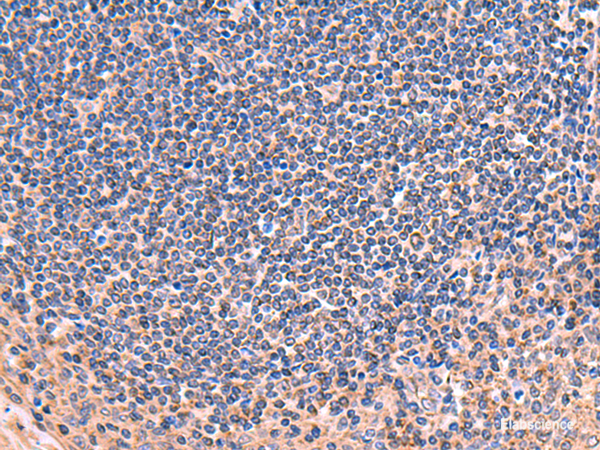 Immunohistochemistry of paraffin-embedded Human tonsil tissue using ZNF256 Polyclonal Antibody at dilution of 1:70(×200)