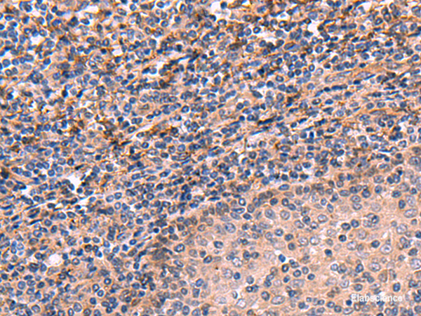 Immunohistochemistry of paraffin-embedded Human tonsil tissue using ARIH2 Polyclonal Antibody at dilution of 1:70(×200)