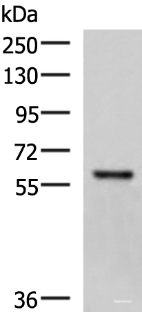 Western blot analysis of Mouse skeletal muscle tissue lysate using MYOT Polyclonal Antibody at dilution of 1:1000