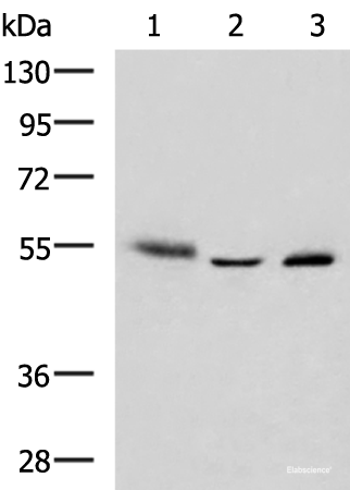 Western blot analysis of Human skin tissue A172 cell Human bladder transitional cell carcinoma grade 2-3 tissue lysates using IKZF2 Polyclonal Antibody at dilution of 1:950