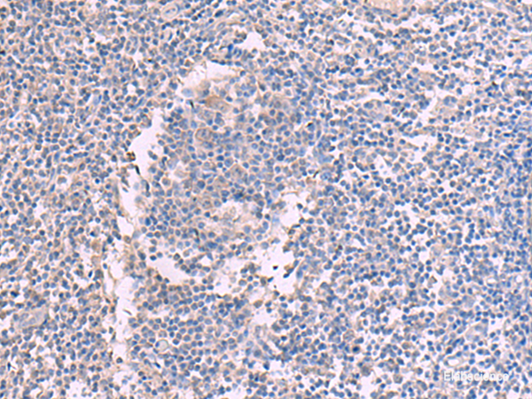 Immunohistochemistry of paraffin-embedded Human tonsil tissue using CCT5 Polyclonal Antibody at dilution of 1:60(×200)