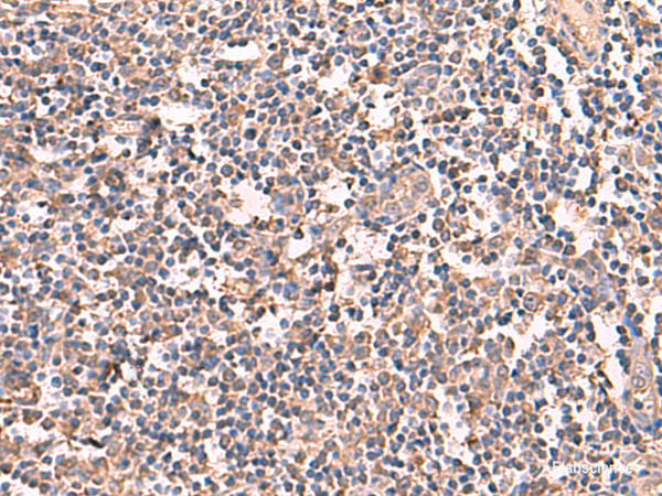 Immunohistochemistry of paraffin-embedded Human tonsil tissue using RIOK1 Polyclonal Antibody at dilution of 1:60(×200)