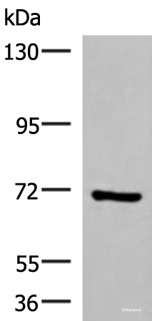 Western blot analysis of HepG2 cell lysate using PAPSS2 Polyclonal Antibody at dilution of 1:1000
