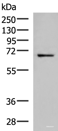 Western blot analysis of 231 cell lysate using GSPT2 Polyclonal Antibody at dilution of 1:650