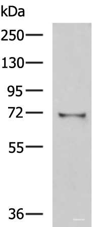 Western blot analysis of Mouse kidney tissue lysate using GSTCD Polyclonal Antibody at dilution of 1:1000