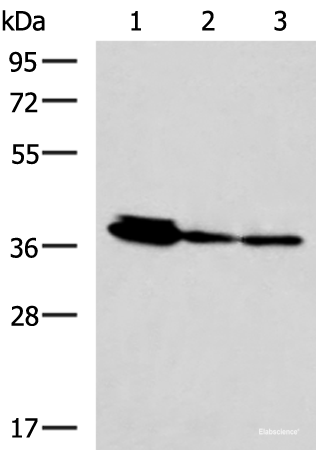 Western blot analysis of HepG2 A172 and A549 cell lysates using EEF1D Polyclonal Antibody at dilution of 1:800