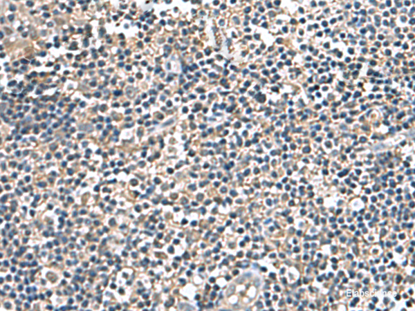Immunohistochemistry of paraffin-embedded Human tonsil tissue using IP6K2 Polyclonal Antibody at dilution of 1:140(×200)
