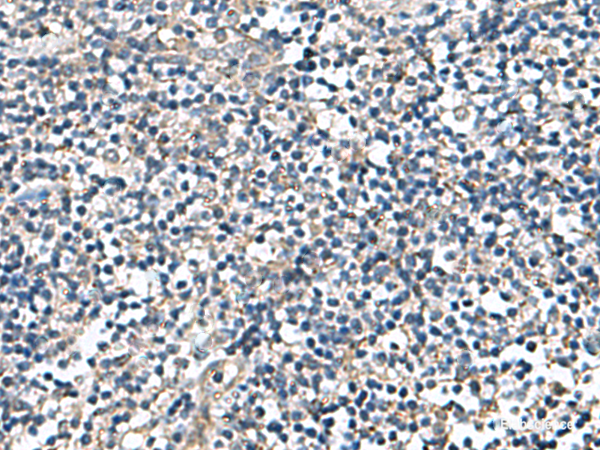Immunohistochemistry of paraffin-embedded Human tonsil tissue using DPY19L3 Polyclonal Antibody at dilution of 1:110(×200)