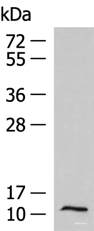 Western blot analysis of Human fetal liver tissue lysate using PCBD1 Polyclonal Antibody at dilution of 1:1000