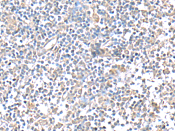 Immunohistochemistry of paraffin-embedded Human tonsil tissue using IFI27 Polyclonal Antibody at dilution of 1:80(×200)