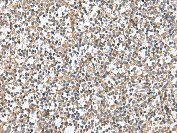 Immunohistochemistry of paraffin-embedded Human tonsil tissue using PTPRS Polyclonal Antibody at dilution of 1:110(×200)