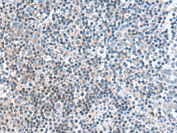 Immunohistochemistry of paraffin-embedded Human tonsil tissue using FAM107B Polyclonal Antibody at dilution of 1:160(×200)