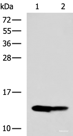 Western blot analysis of Mouse liver tissue and Mouse kidney tissue lysates using RIDA Polyclonal Antibody at dilution of 1:650