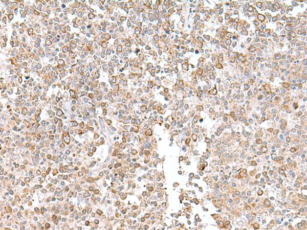 Immunohistochemistry of paraffin-embedded Human tonsil tissue using EIF1AY Polyclonal Antibody at dilution of 1:55(×200)