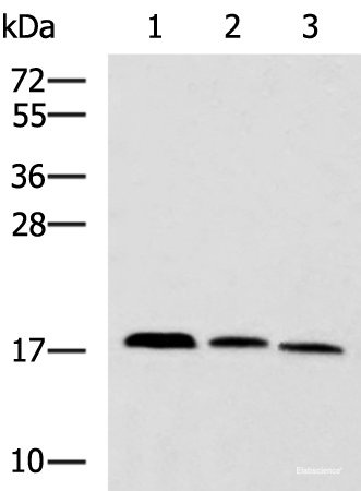 Western blot analysis of Mouse kidney tissue Rat brain tissue Mouse liver tissue lysates using CPLX3 Polyclonal Antibody at dilution of 1:950