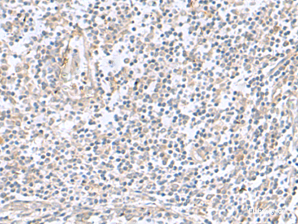 Immunohistochemistry of paraffin-embedded Human tonsil tissue using TNNC2 Polyclonal Antibody at dilution of 1:50(×200)
