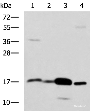 Western blot analysis of Mouse Pancreas tissue Mouse small intestines tissue Mouse large intestine tissue Human sigmoid tissue lysates using ZG16 Polyclonal Antibody at dilution of 1:1350